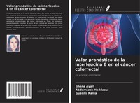 Valor PronóStico De La Interleucina 8 En El CáNcer Colorrectal Jihene Ayari
