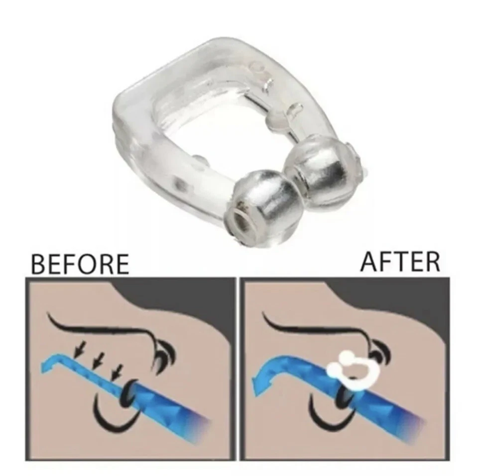 3x Schnarch Stopper Magnet Nasenclip Schnarchen Schnarchstopper+Aufbewahrungsbox - Bild 4 von 4