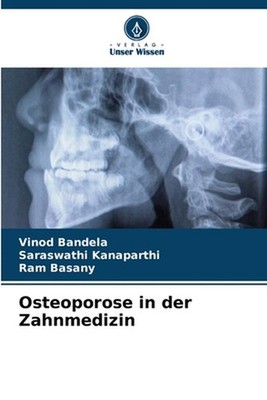 Osteoporose in der Zahnmedizin by Vinod Bandela (German) Paperback Book