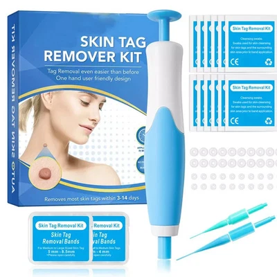 Natural Painless Auto SKIN TAG Removal Kit Skin Tag Micro Bands Remover Device