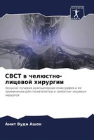 Amit Vudi Ashok | Cbct W ChelüStno-Licewoj Hirurgii | Taschenbuch | Russisch