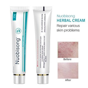 topical cream for pimples