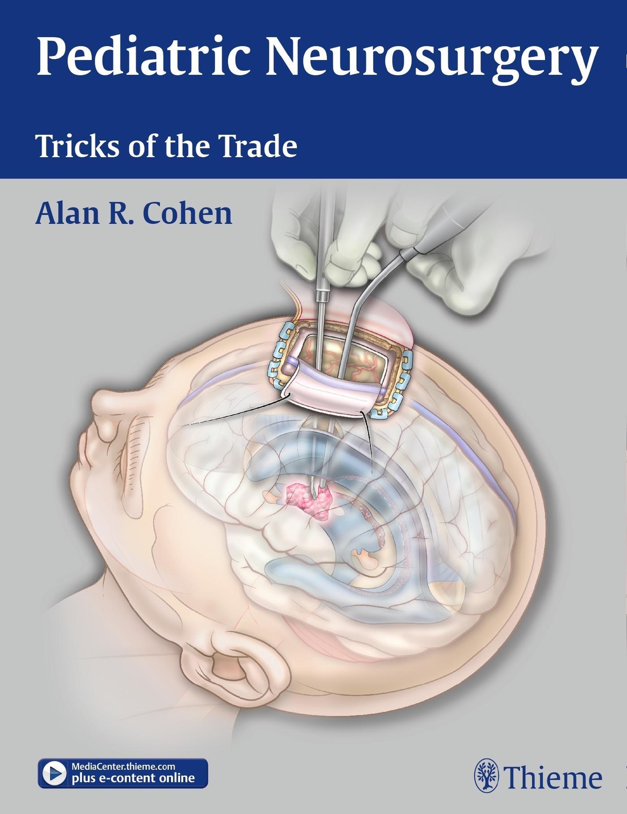 Thumbnail - Pediatric Neurosurgery: Tricks Of The Trade: Plus E-content Online
