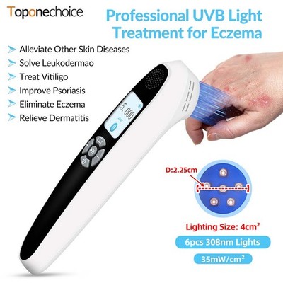 Portable 308nm UVB Phototherapy Device Clinical Grade for Skin Treatment 35mW