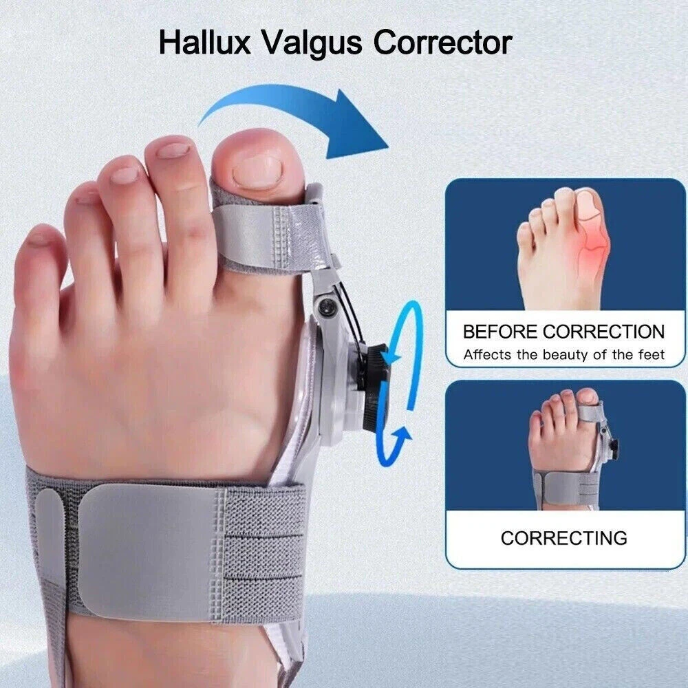 Treatmedy Bunion Fix Toe Valgus Corrector Adjustable Orthosis Splints Women Men 