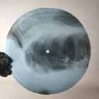 PINK FLOYD FAT OLD SUN X-Ray USSR Record Roentgen Bone Ribs Music Vinyl