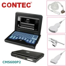 CMS600P2 Portable Ultrasound Scanner Diagnostic Laptop Machine Convex Linear FDA