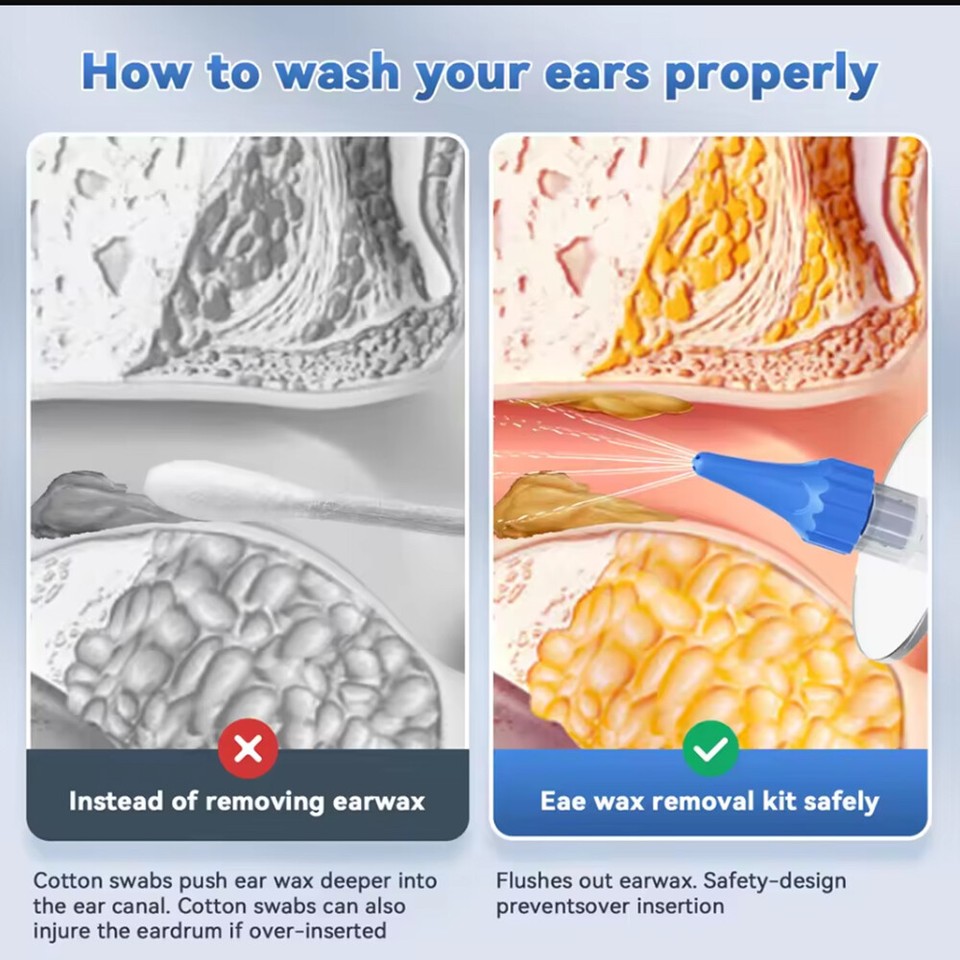 Ear Wax Removal Kit Ear Cleaning Kit for Adults - Ear Syringe Kit Pain ...