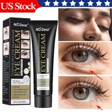 Wrinkle Remover Instant Anti-Aging Retinol EYE Cream Skin Tightening Firming 15g