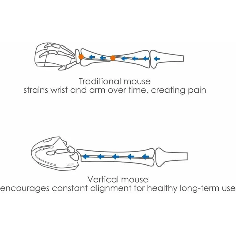 Vertical Mouse 5 Buttons 1000 / 1600 DPI Ergonomic Optical USB Wired Anker - Image 4 of 4