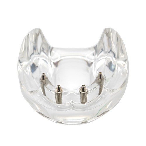 Multiple Types Dental Teeth Model Ortho Implant Practice Teaching Demo Model - Picture 275 of 276