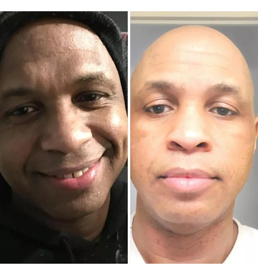 SKIN LIGHTENING TREATMENT: TRATAMIENTO EFECTIVO PARA BORRAR MANCHAS OSCURAS, 2oz - Image 3 of 4