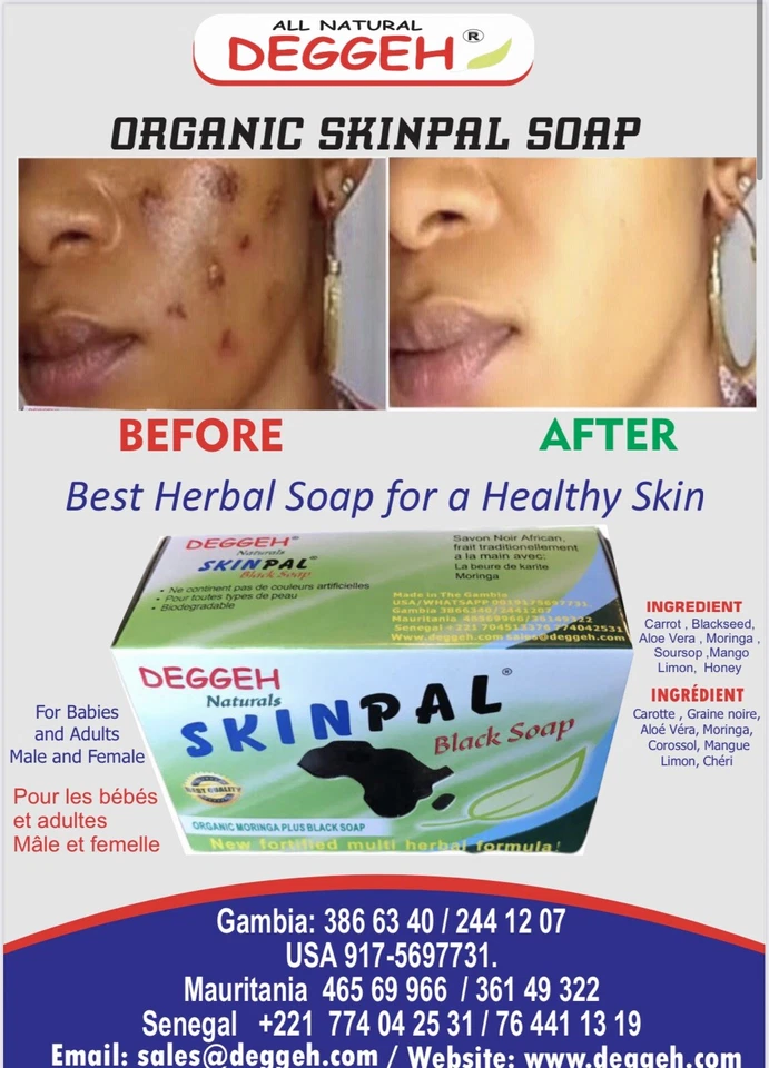 MORINGA Organic Herbal African Black Soap- 12 - Image 2 of 4