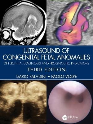 Ultrasound of Congenital Fetal Anomalies, Paladini