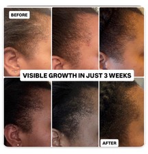 POWERFUL HAIR GROWTH OIL 4oz -5oz 100 NATURAL INGREDIENTS FOR ANY TYPE OF HAIR