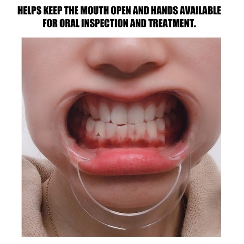 20pcs Disposable Lip Cheek Retractor Transparent CShape Teeth Whitening Mout 3CS - Picture 8 of 12