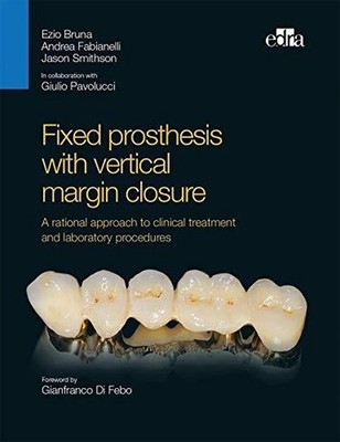 Fixed prosthesis with vertical margin closure. A rational approach to clinical t