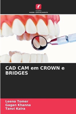 CAD CAM em CROWN e BRIDGES by Leena Tomer Paperback Book