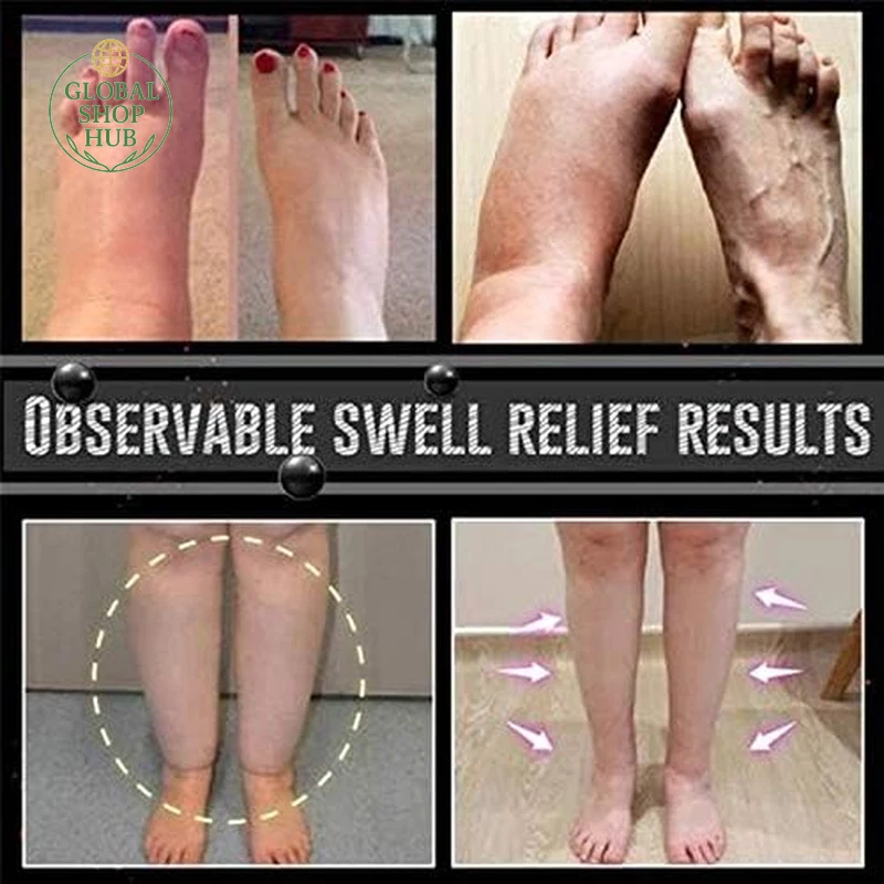 Anti-Swelling Black Obsidian Anklet, 4Pcs Magnetic Therapy Ankle Bracelet, Obsid - Image 4 of 4