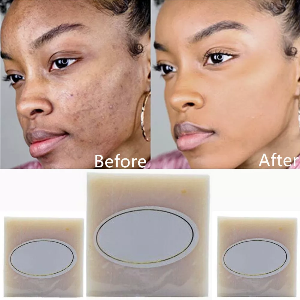 Rice Milk Dark Skin Permanent Bleaching Soap Whitening brightening