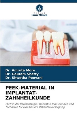 Peek-Material in Implantat-Zahnheilkunde by Dr Amruta More Paperback Book