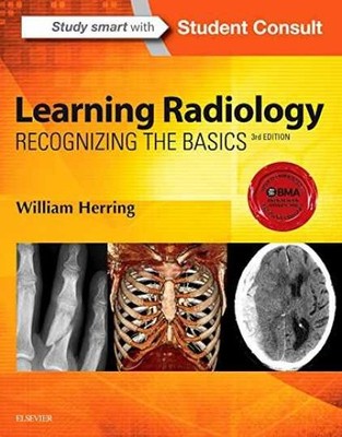 Learning Radiology: Recognizing - Paperback, by Herring MD FACR - Very Good i