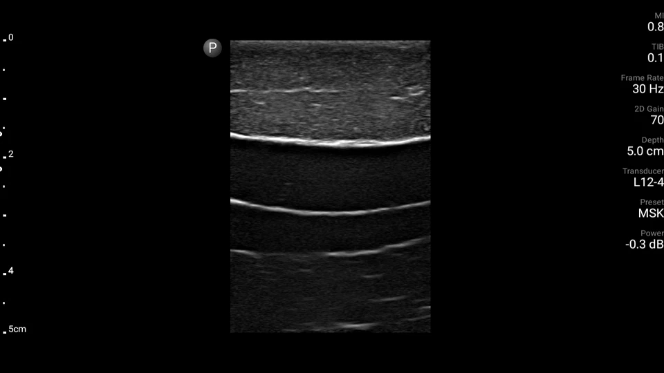Internal Juglar ultrasound phantom -CVC (FLUID FREE) - Image 3 of 4