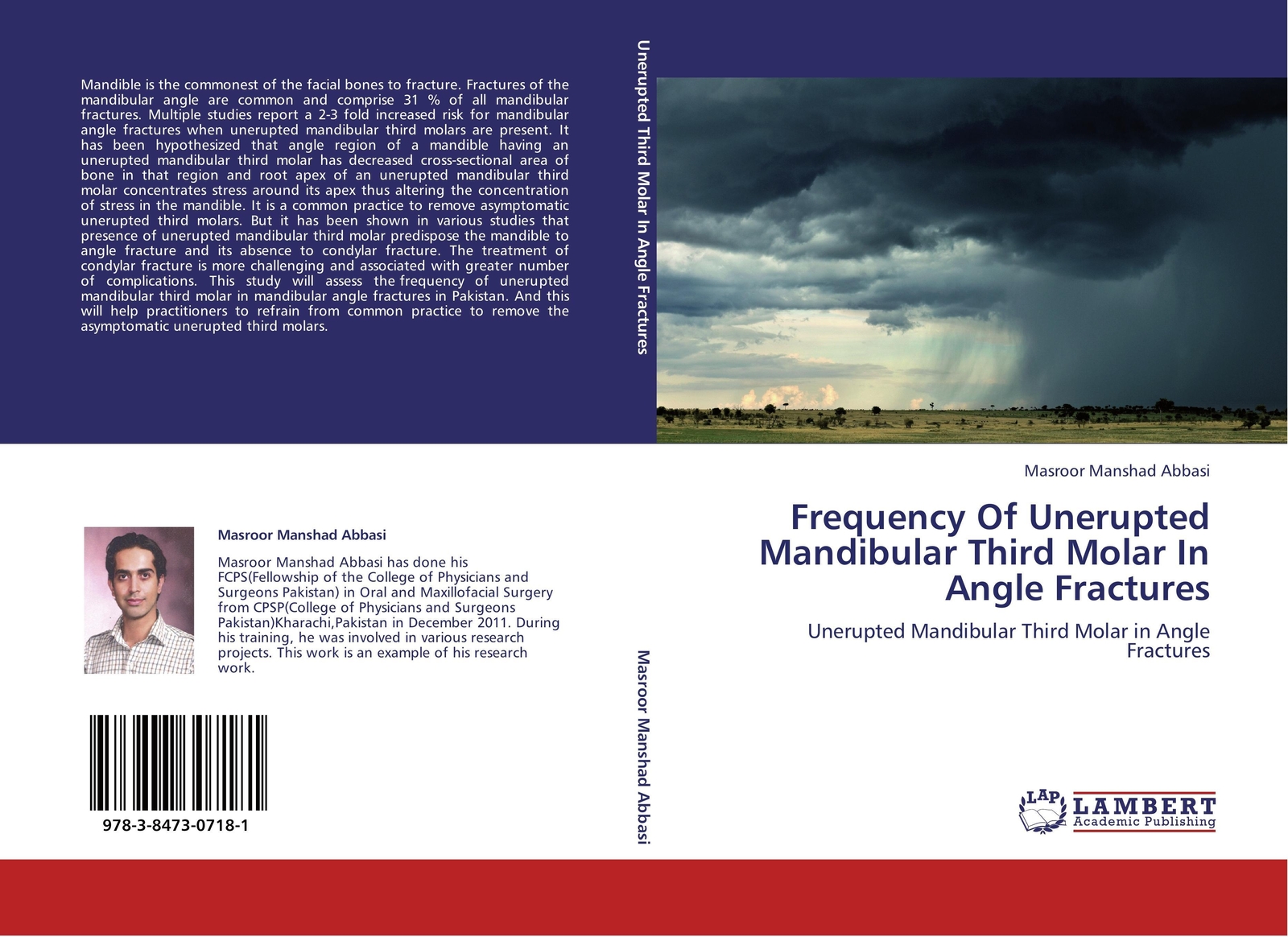 Thumbnail - Masroor Manshad Abbasi | Frequency Of Unerupted Mandibular Third Molar