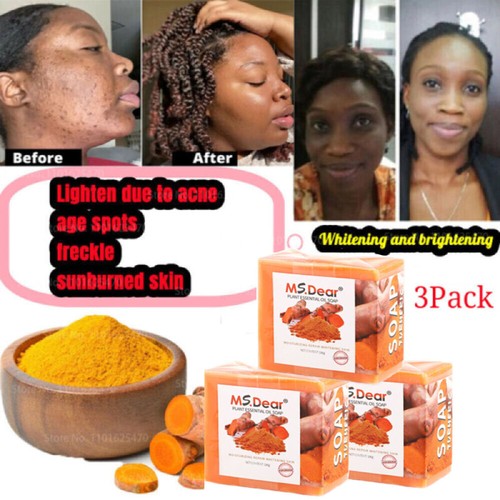 3PCS Turmeric Soap Skin Whitening Dark Spots Lightening Acne Brightening Tumeric - Picture 2 of 19