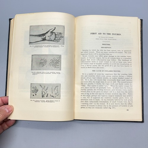 1919 Prevention of Disease and Care of the Sick First Aid Stimpson Public Health - Picture 14 of 24