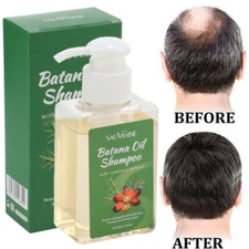 Batana Rosemary Oil Shampoo Batana Anti-Hair Loss Shampoo Rosemary Shampoo 100ml