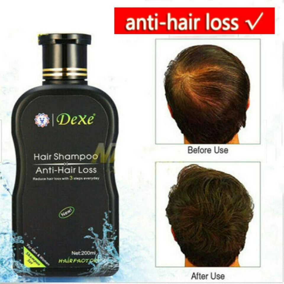 Champú antipérdida de cabello Dexe Original tratamiento natural a base de hierbas para el crecimiento del cabello 200 ml Foto 4 de 4