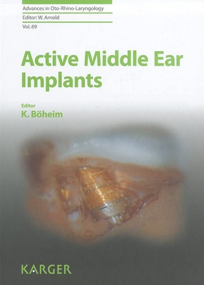 Active Middle Ear Implants (Advances in Oto-Rhino-Laryngology)