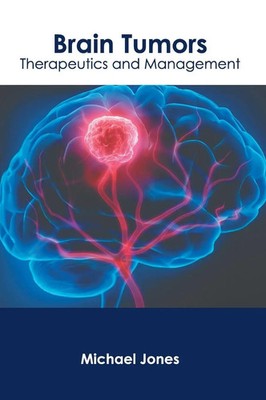 Michael Jones | Brain Tumors | Buch | Englisch (2023) | EAN 9781639279449