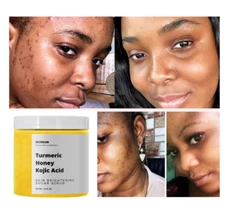 Skin Whitening Dark Spots lightening Acne Brightening Turmeric Honey Kojic Acid