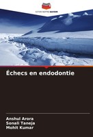 ÉChecs En Endodontie Anshul Arora (U. A.) Taschenbuch FranzöSisch 2025