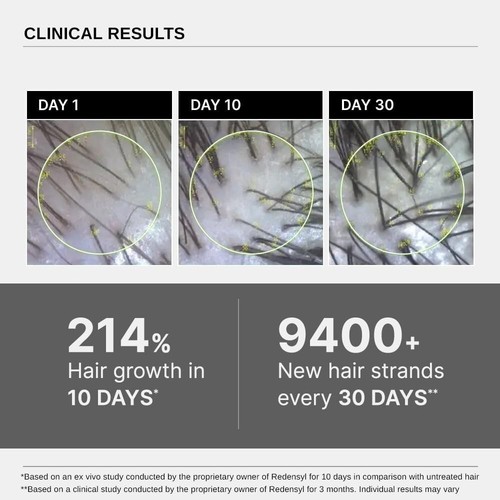 Bare Anatomy Advanced Hair growth serum : Rosemary, Biotin & Rice Extract : 30ml - Picture 7 of 8