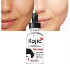 ROUSHUN Kojic Acid Skin lightening Natural treatment Face Serum 30 ml Exp 2029