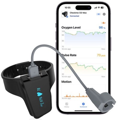 Wellue Checkme O2 Max Smartes Handgelenk Pulsoximeter mit Ringsensor 72 Std, DE