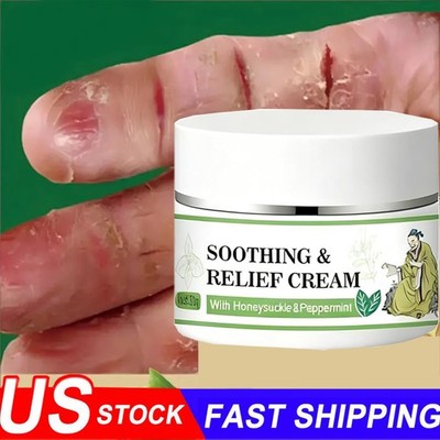 Soothing & Relief Cream Natural Herbal Cream Gentle Instant Soothing and Repair.