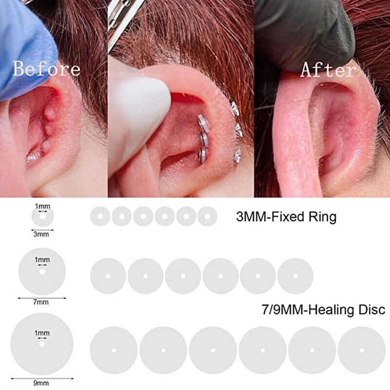 Silicone Piercing Healing Discs Flexible Anti Hyperplasia Saucer For Ear  Stud