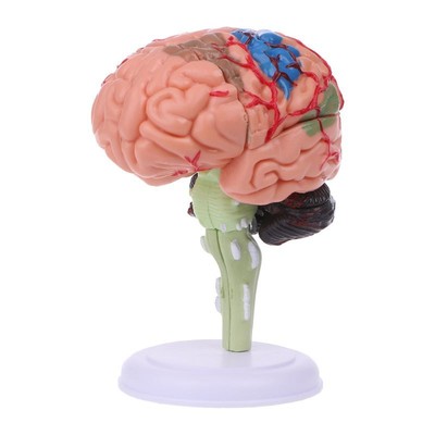 4D Disassembled Anatomical Human Brain Model Anatomy Medical Teaching Tool Use