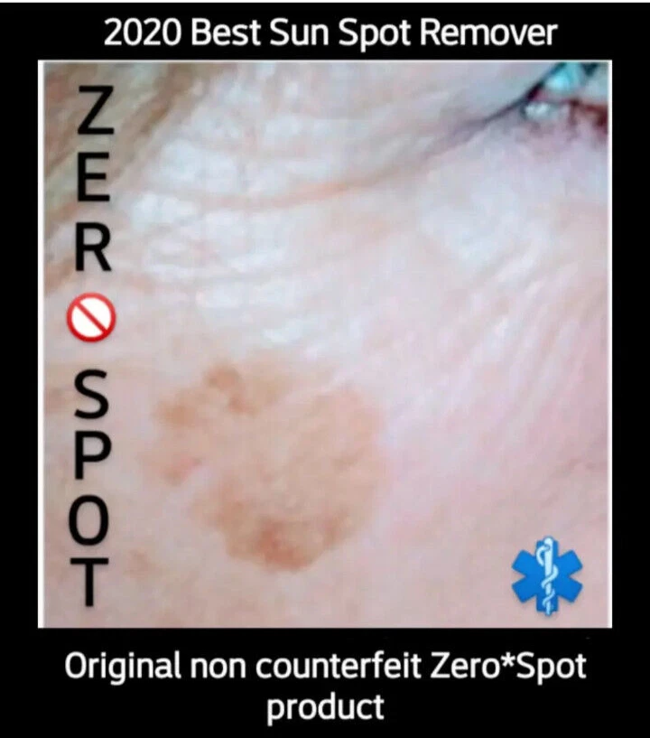 Sunspot Face , Age Spot Corrector, Brown Spot Remover Treatment works 3X FASTER