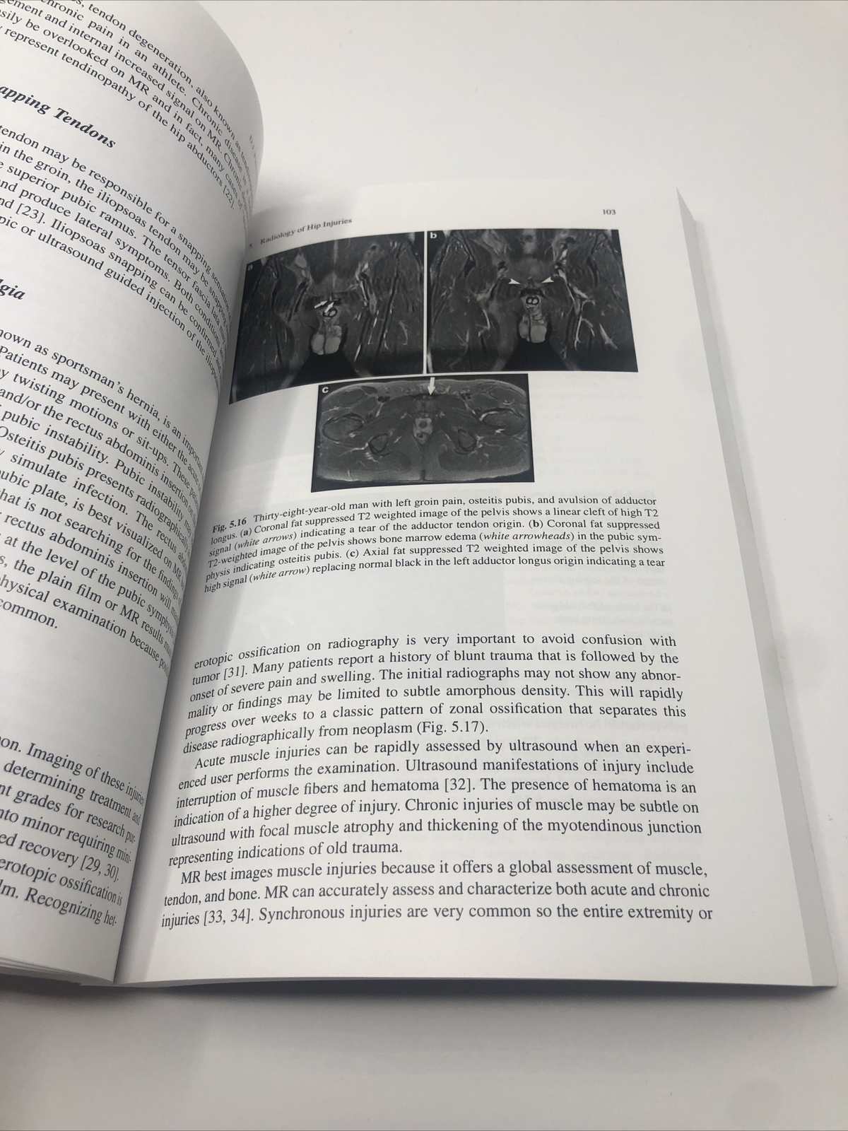The Hip and Pelvis in Sports Medicine and Primary Care 2nd Edition ...