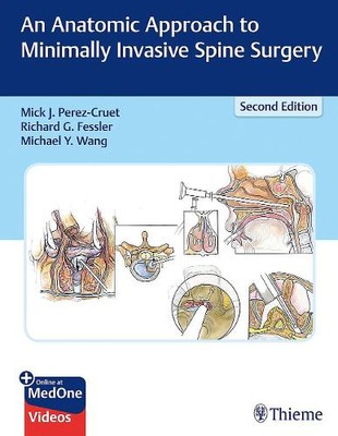 An Anatomic Approach to Minimally Invasive Spine Surgery Perez cruet Fessler