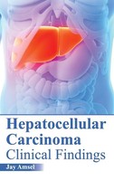 Jay Amsel | Hepatocellular Carcinoma | Buch | Englisch (2015) | Gebunden