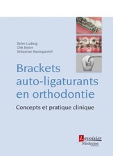 Brackets Auto-ligaturants Orthodontie Concepts Pratique Clinique arcs dentaires