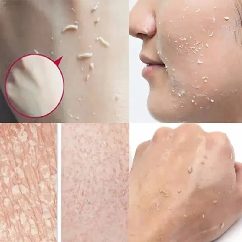 Exfoliante facial hidratante nutritivo reparador exfoliante limpiador facial eliminación de espinillas Foto 4 de 4