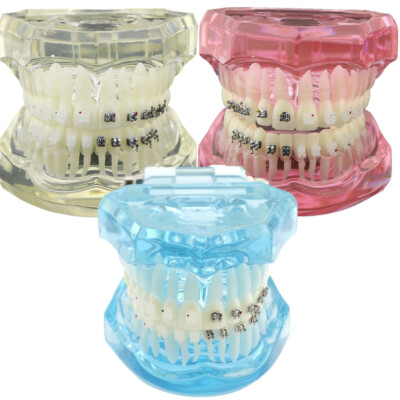 Dental Orthodontic Teeth Study Model with Metal Ceramic Bracket Braces 3003