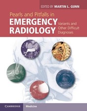 Pearls Pitfalls Emergency Radiology Variants ...